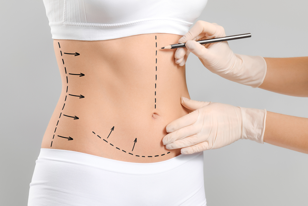 Body Contouring